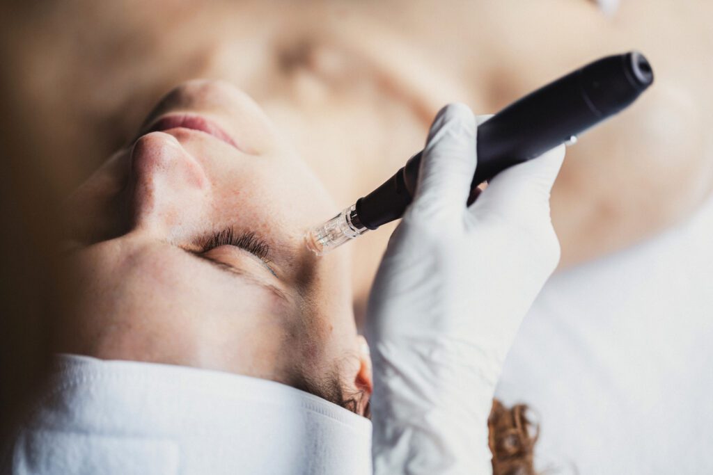 Radiofrequency Microneedling Training: Why Accreditation Matters for Your Clinic | Skinology UK Radiofrequency Microneedling Training: Why Accreditation Matters for Your Clinic | Skinology UK
